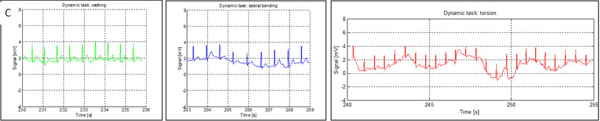 Microneedles technology assessment