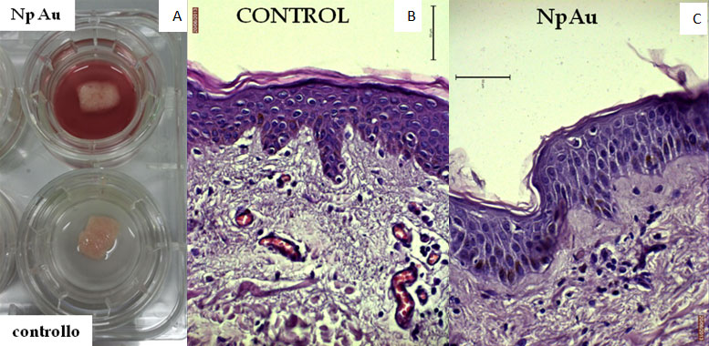 Nanotoxicity in human tissues