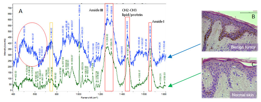 Raman spectroscopy